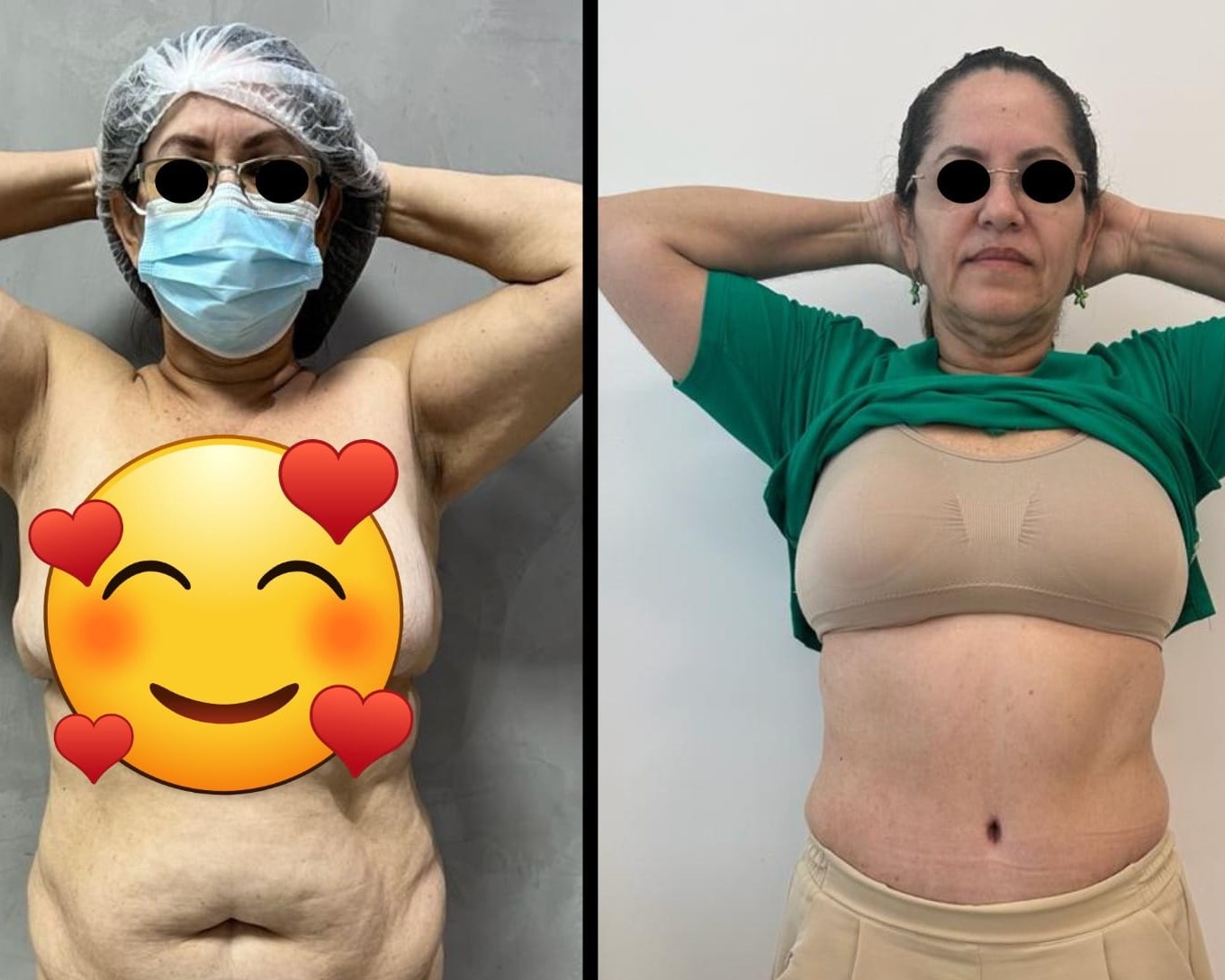 abdomen